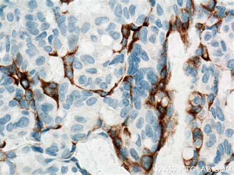 Cytokeratin 5 antibody (66727-1-Ig) | Proteintech | 武汉三鹰生物技术有限公司
