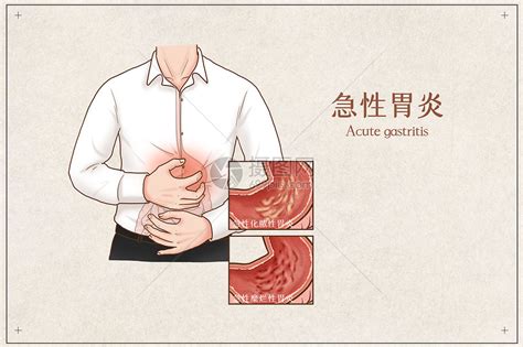 胃炎疼痛位置图图片