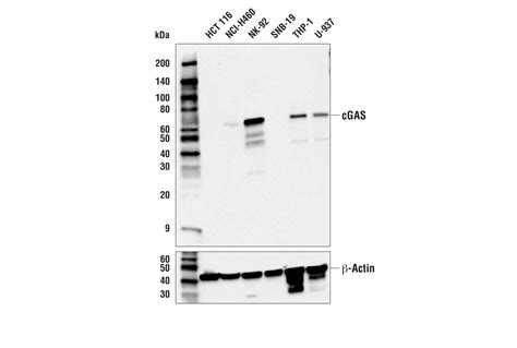 Inhibition of NFkB pathway re-sensitizes MLS resistant-cells to ...