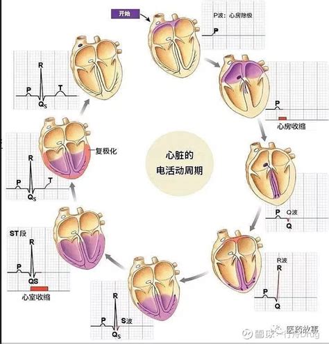双心房节律—起搏器综合征的少见原因_医学界-助力医生临床决策和职业成长