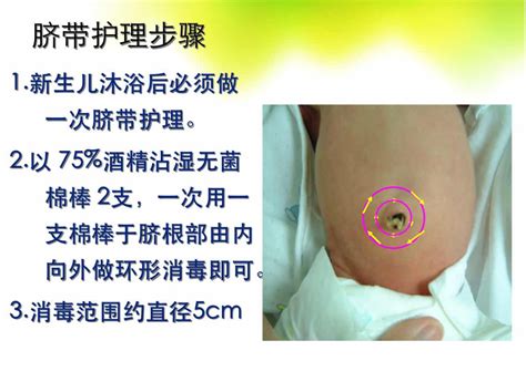 脐茸图片
