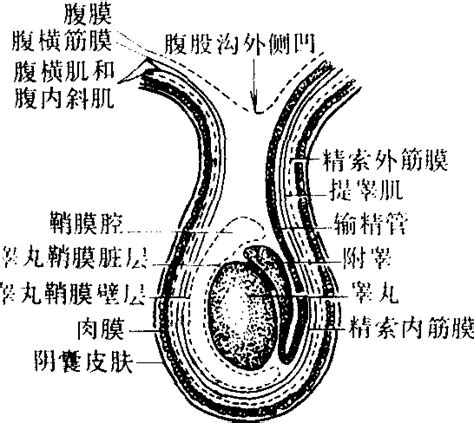 睾丸下垂图片