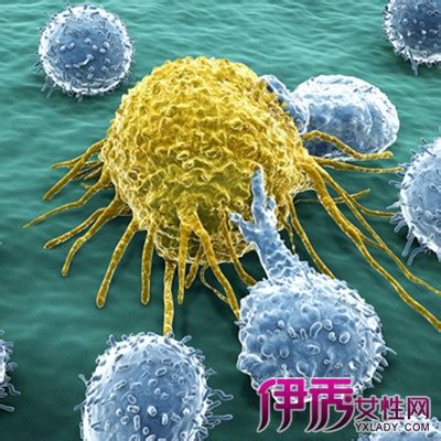 中国每分钟约有 5 人死于癌症！预防癌症，这4点你都能做到 - 知乎