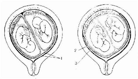 图18～37 单合子的单卵双胎-功能组织学与胚胎学-医学