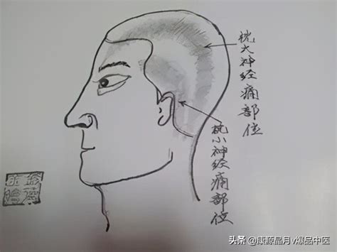 后脑勺详细部位图图片