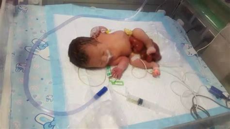 刚出生女婴大年初二被弃医院 消化器官都露在肚子外_社会_环球网