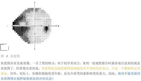 视野缺损自测图图片