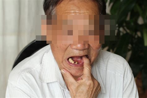 郑州种植牙|老人种植牙有什么注意 - 知乎