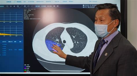 张康教授参与研发的人工智能诊断系统20秒内能准确诊断新冠肺炎