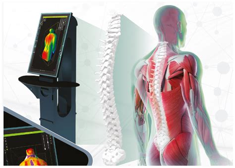 Spine 3D脊柱扫描-上海礼昆医疗器械有限公司