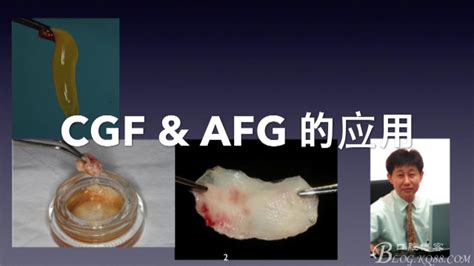 （22）CGF&AFG临床应用（朴东信）-李 钢的博客-KQ88口腔博客