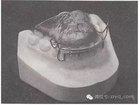 肌激动器图片