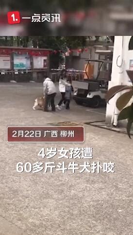 4岁女孩被斗牛犬咬伤 狗主人：狗挣脱绳子自行跑出-千龙网·中国首都网