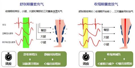 躺在床上，使血管“更年轻”——神奇的体外反搏_北京中西医结合医院 | 医院始终以提高医疗质量和服务水平为目标，以充分发挥中医药特色为优势。现设 ...