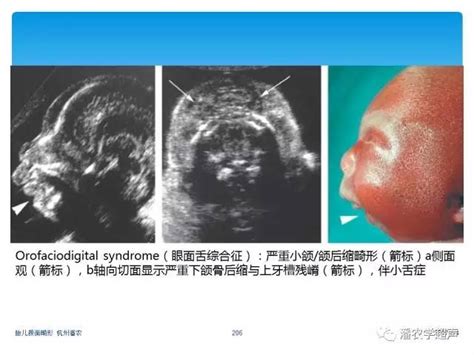 大畸形筛查可以查出胎儿所有的畸形吗？__上海百佳妇产医院【官网】