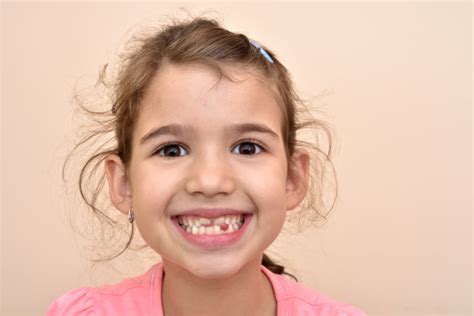 小孩子的牙齿正常图片,子牙齿图片,子牙齿掉图片_大山谷图库