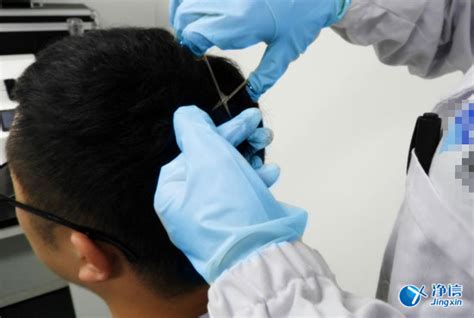 上海净信：毛发毒品检测仪检测毛发的优势及步骤详解-上海净信