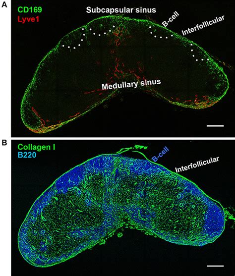 medullarysinus雷克萨斯rx450h报价2022已更新今日更新