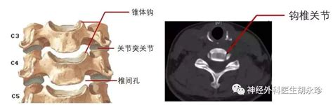 钩椎关节解剖图图片