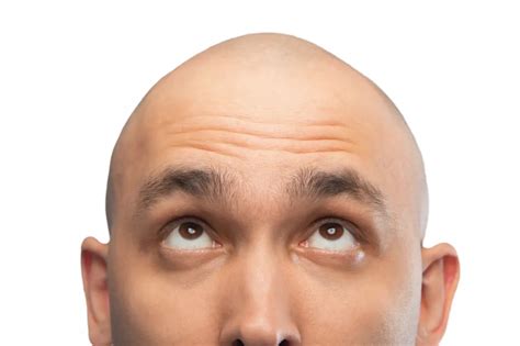 头发有救了！科学家发现刺激头发生长的分子！|头发|毛乳头|脱发_新浪新闻