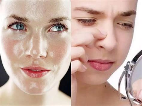 过敏性皮肤如何保湿 详解五种常见皮肤的补水方法|过敏性|皮肤-爱美·BEAUTY-川北在线