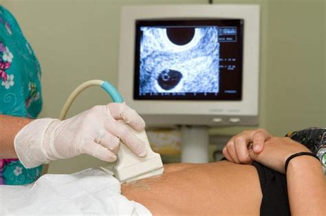 怀孕多久b超能看到胎心胎芽-菠萝孕育