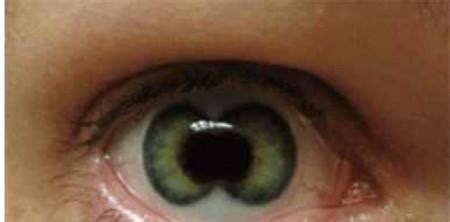 地球四种罕见瞳色！有你眼睛颜色吗？异瞳真实存在吗？
