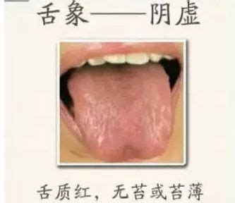 饕口馋舌的意思_成语饕口馋舌的解释-汉语国学