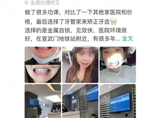 2022北京牙科收费价目表:中诺种植牙/禾禾齿科正畸价格也有 - 爱美容研社