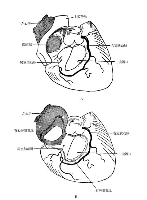 图7-3 左、右心房的关系-心脏外科基础图解-医学