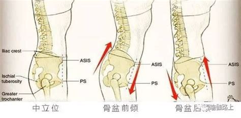 测量骨盆演示图图片