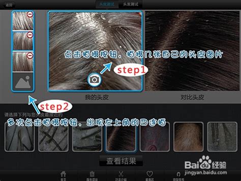 头皮发和皮肤的显微镜检查高清图片下载-正版图片503817543-摄图网