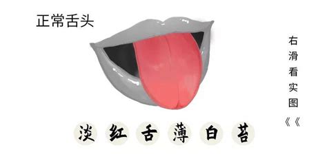 5种常见舌相学起来，出现第四种需要及时就医！_舌头