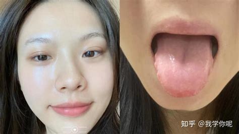 湿气重的舌头图片