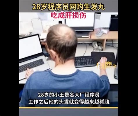 28岁程序员网购生发丸吃成肝损伤，医生：成分有肝毒性-中国网