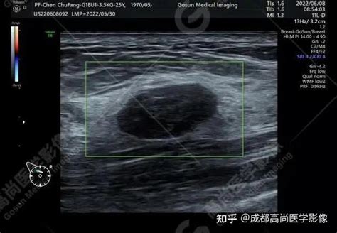 超声图像图片