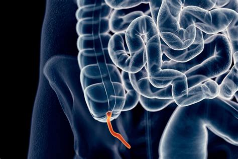 Appendix Pain: Causes, Treatment, and When to See a Doctor