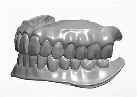 中国首套复杂义齿人工智能三维设计软件：维视全口义齿设计软件(3D医学数字牙科CAD/CAM) - 知乎