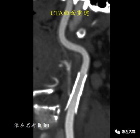 颈蹼图片