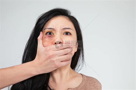 被丈夫家暴的妻子满脸淤青高清图片下载-正版图片501532401-摄图网