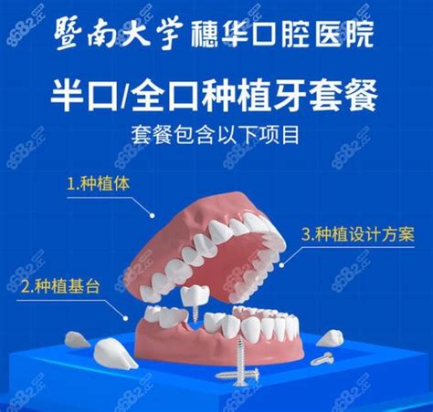 广州口腔连锁机构排名榜前十,穗华|广大|柏德牙科排行前三,种植牙-8682赴韩整形网