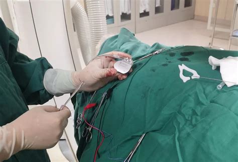 郑州大学附属洛阳中心医院顺利植入了河南省首台心系列国产心脏起搏器 -- 严道医声网