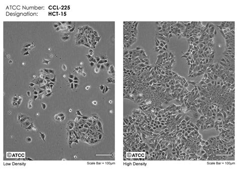 HCT-15细胞ATCC CCL-225细胞 HCT15人结直肠腺癌细胞株购买价格、培养基、培养条件、细胞图片、特征等基本信息_生物风