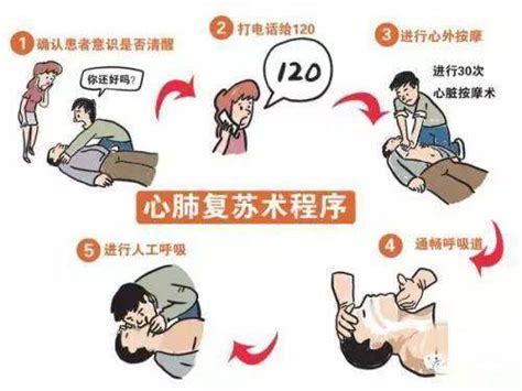 心肺复苏图片