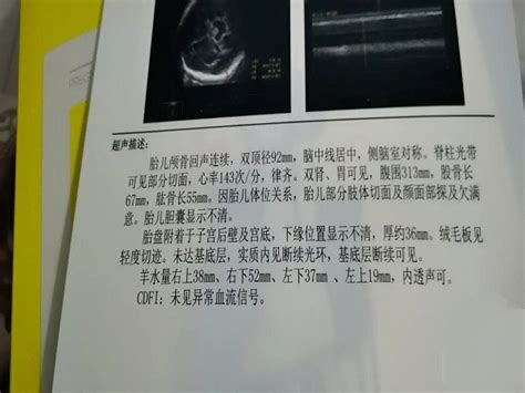 1～40周胎儿股骨长标准数值表，是否正常对照看看就知道_家庭医生在线