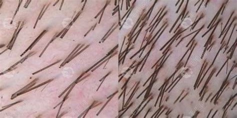 头皮发和皮肤的显微镜检查高清图片下载-正版图片506614109-摄图网