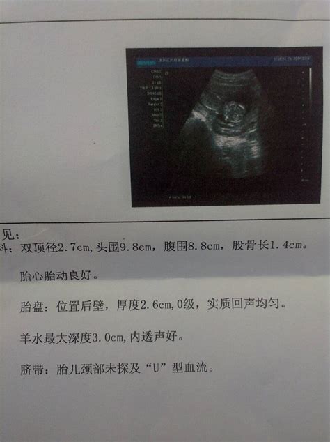 整蛊怀孕B超单生成器