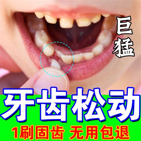 牙疼牙齿松动药专治牙龈肿痛出血萎缩牙晃动固定器固齿胶填充牙膏-淘宝网