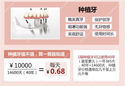 40-50种牙2023价格表：40-50岁种植单颗、多颗和半口牙的人很多 - 口腔健康 - 毛毛网