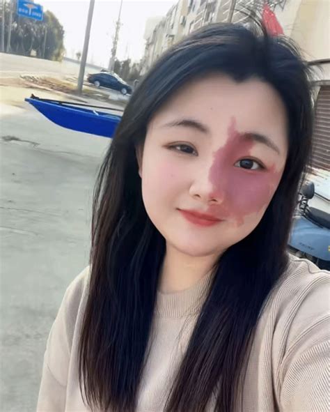 熊黛林大胎记图片